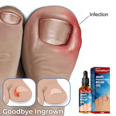 German ToenailPlus™ Anti Paronychia Relief Oil Nail Fungus